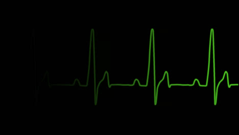 Medical EKG Heart Rate Monitor at Hospit, Stock Video