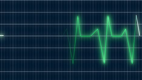 EKG-Herzfrequenzdiagramm-2