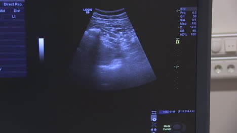 Ultrasound-Screen-2