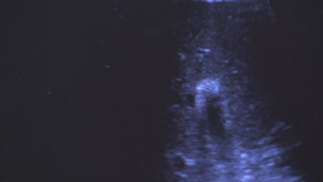 Ultrasound-Scan-5
