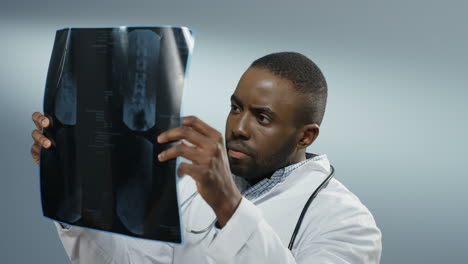 Close-Up-Of-The-Young-Man-Doctor-Or-Intern-Holding-X-Ray-Copy-And-Studying-It-Carefully-On-The-Grey-Background