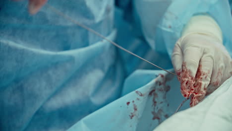 Close-Up-View-Of-The-Hands-Of-A-Surgeon-Wearing-Gloves-Full-Of-Blood-While-Performing-An-Operation