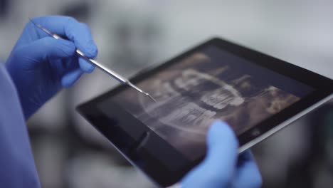Close-Up-Of-Gloved-Hands-Of-Unrecognizable-Dentist-Holding-Periodontal-Scaler-And-Pointing-At-Jaw-X-Ray-On-Tablet