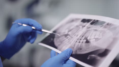 Nahaufnahme-Der-Behandschuhten-Hände-Eines-Nicht-Erkennbaren-Zahnarztes,-Der-Einen-Parodontalen-Scaler-Hält-Und-Ein-Panorama-Röntgenbild-überprüft