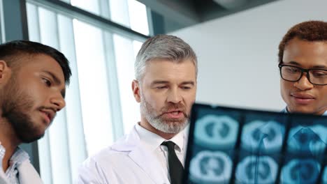 Neumólogo-Serio-Discutiendo-La-Radiografía-De-Los-Pulmones-Del-Paciente-Con-Compañeros-De-Trabajo-Durante-El-Período-Epidémico