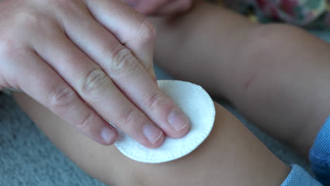 Mother-Disinfects-Child's-Abrasion-Wound-with-Spray-and-Cotton-Pad-Close-Up