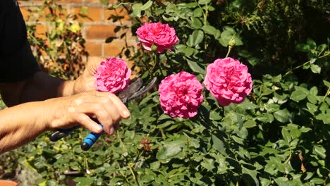 Woman-with-vitiligo-on-her-hands-working-in-the-garden-1