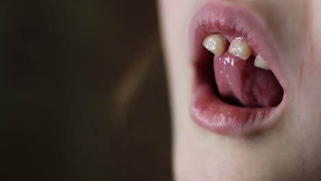 Close-Up-Of-Young-Girl-Wiggling-Loose-Front-Teeth-With-Tongue