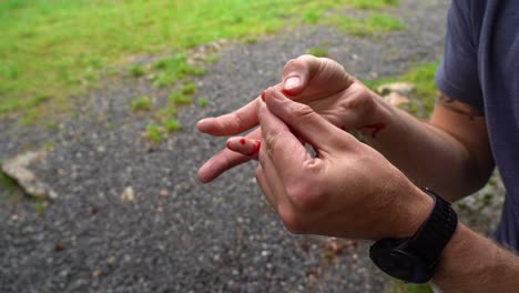 Man-in-nature-cut-his-little-finger-and-is-squeezing-his-wound-in-front-of-camera-while-blood-is-pouring-out-over-his-hands---Close-up-of-hands-and-wound-with-no-face