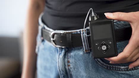 Hand-of-diabetic-female-showing-switched-off-insulin-pump-on-her-belt