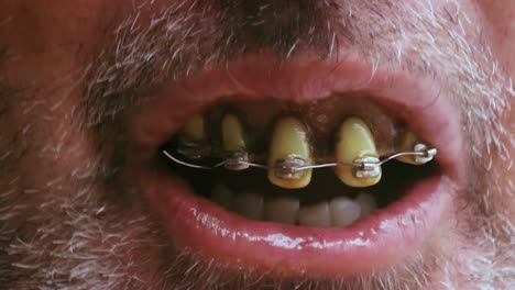 Makroaufnahme-Eines-Ekelhaften-Mundes-Mit-Hässlichen-Zähnen-Und-Nassen-Lippen,-Die-Mit-Der-Kamera-Sprechen
