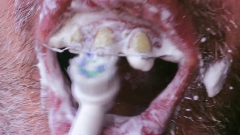 Lustige-Nahaufnahme-Eines-Hässlichen-Zahnigen-Mundes-Mit-Gelben-Zähnen-Und-Gebrochenen-Zahnspangen-Beim-Zähneputzen