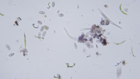 Diferentes-Especies-De-Agua-Dulce-De-Protozoos-Organismos-Unicelulares-Como-Estentores,-Ciliados-Y-Movimiento-De-Algas-Bajo-El-Microscopio-Vista-Archivada-Brillante