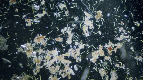 Diferentes-Especies-De-Agua-Dulce-De-Protozoos-Organismos-Unicelulares-Como-Estentores,-Ciliados-Y-Movimiento-De-Algas-Bajo-El-Microscopio-Vista-De-Campo-Oscuro