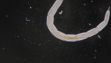 Sich-Schnell-Bewegender-Nematoden-Trematodenwurm-Unter-Mikroskop-Dunkelfeldansicht