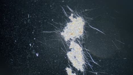 Cyanobakterien-Algenbewegung-Im-Licht-Unter-Mikroskop-Dunkelfeldansicht