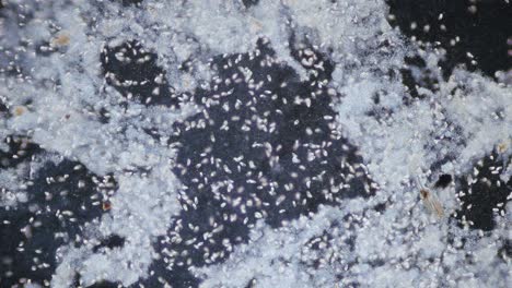 Mikroorganismen-Ciliates-Und-Algen-Hochkonzentrierte-Mikroskopische-Dunkelfeldansicht