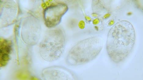 Paramecium-Population-Mit-Hoher-Dichte-Im-Mikroskop-Hell-Abgelegt