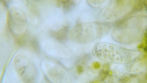 Paramecium-Population-Mit-Hoher-Dichte-Im-Mikroskop-Hell-Abgelegt