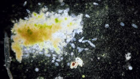Paramecium-high-density-population-in-microscope-dark-field