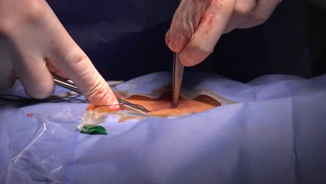 La-Sutura-Quirúrgica-Es-Un-Dispositivo-Médico-Que-Se-Utiliza-Para-Mantener-Unidos-Los-Tejidos-Del-Cuerpo-Después-De-Una-Lesión-O-Cirugía