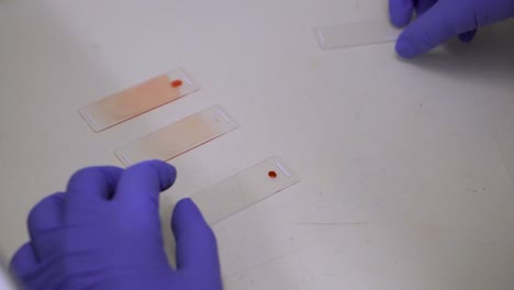 Placing-Drop-Of-Blood-Sample-On-One-End-Of-Glass-Microscope-Slide---Blood-Film
