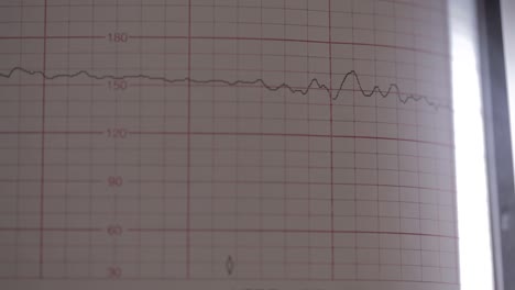 Nahaufnahme-Eines-Herzmonitorbildschirms,-Der-Messungen-An-Einem-Baby-Im-Bauch-Einer-Schwangeren-Frau-Durchführt,-Das-Auf-Papier-Aufgezeichnet-Wird