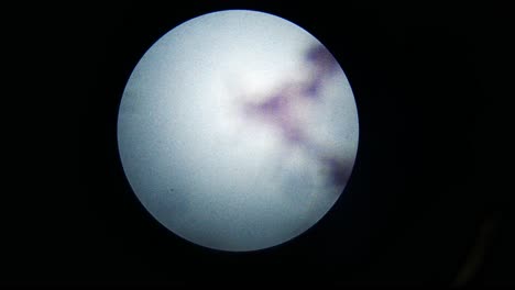 Fokussierung-Auf-Mikroskop-Auf-Mikroben